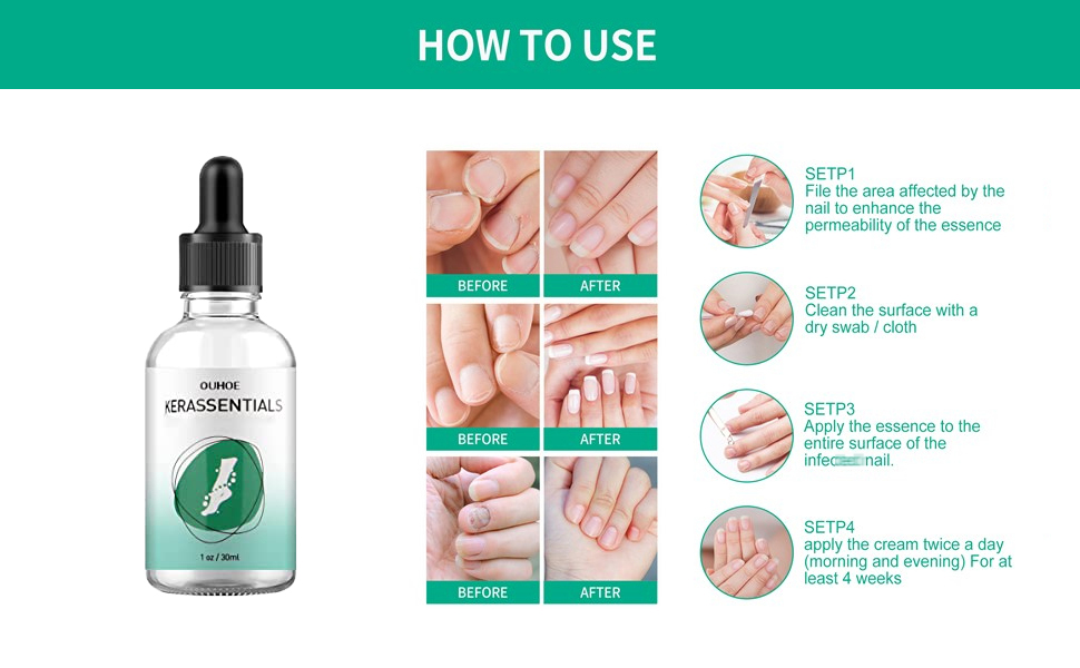 How to Use Kerassentials