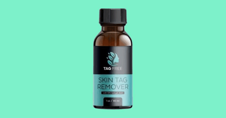 Tag Free Skin Tag Remover Review